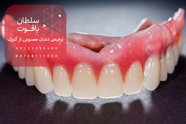ترخیص-دندان-مصنوعی-از-گمرک